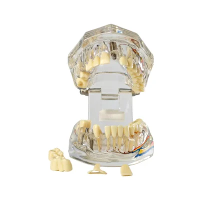 Evodent All in One with Nerve Supply Clear