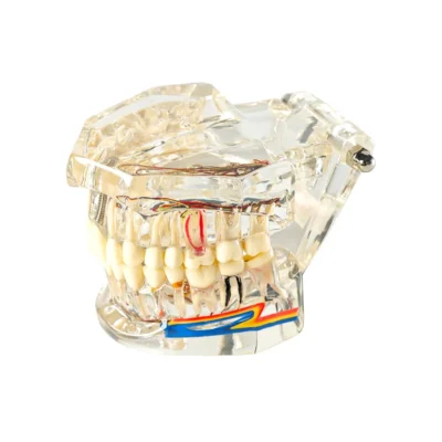 Evodent All in One with Nerve Supply Clear Showing Clear Dental Model with Visibale Nerve Supply and Full Tooth Anatomy Demonstration