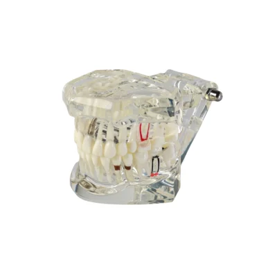 Evodent all in one dental scan displaying detailed tooth structures with clear visibility of pathology image also highlights implant placement with high-resolution clarity