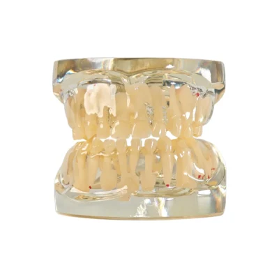 Evodent Mixed Dentition Model without Caries-Clear Transparent mixed dentition model by Evodent featuring developing primary and permanent teeth The clear material highlights internal structures and growth stages with no caries present