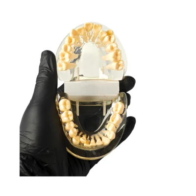 Evodent Orthodontic Model Class I Malocclusion Clear