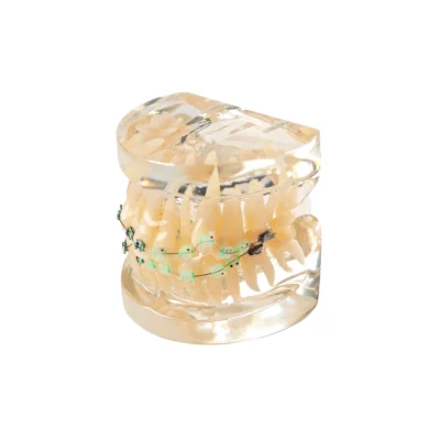 Evodent Orthodontic Model Half Metal & Half Ceramic Bracket