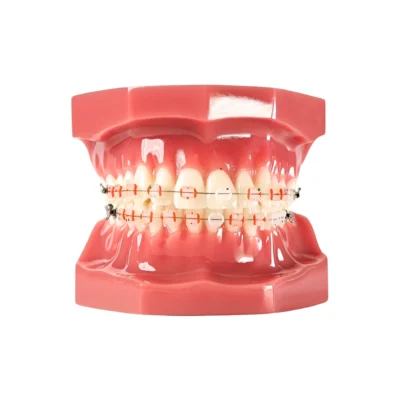 Evodent Orthodontic Model with Ceramic Bracket Pink Showing Pink Gums and Alignment and Bite Stracture of Training and Demonstartion.