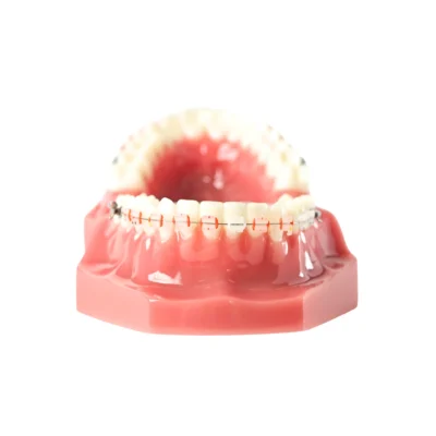 Evodent Orthodontic Model with Ceramic Bracket Pink