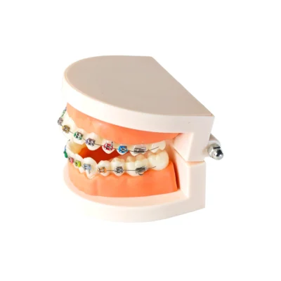 Evodent Orthodontic Model with Metal Bracket Evodent Orthodontic Model with Metal Bracket