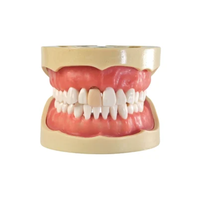 Evodent Root Canal Model with Jaw and Removable Tooth Showing Root Canal Anatomy and Procedure steps