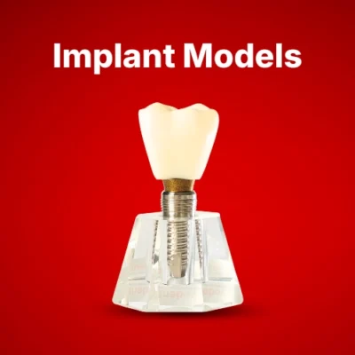 Implant Models