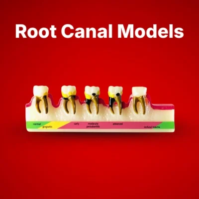 Root Canal Model